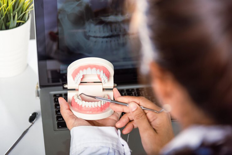 teeth whitening bleach