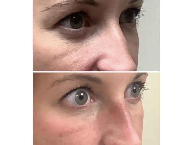 juvederm washington dc
